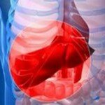 Признаки жирового гепатоза на узи